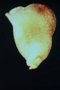 Acera, or the Witches’ Dance